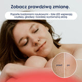 ZENT® DermaLight™ – Inteligentna maska LED do zaawansowanej terapii światłem 4w1