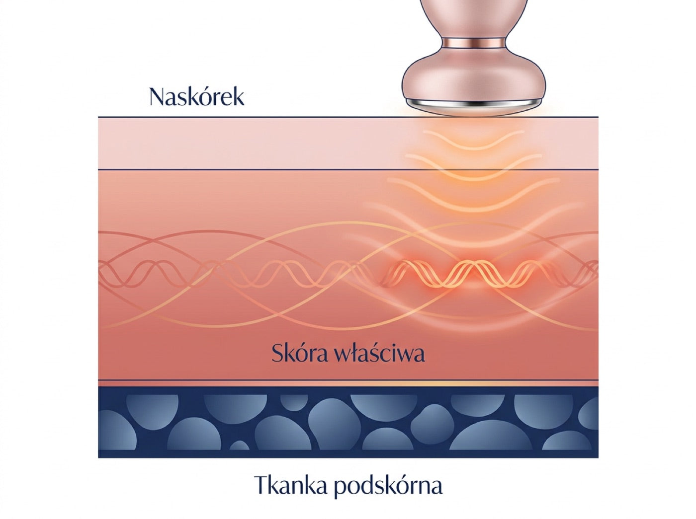Ilustracja poglądowa. Jak ciepło RF wnika w głębsze warstwy skóry, docierając tam, gdzie krem i masaż ręczny nie sięgają.